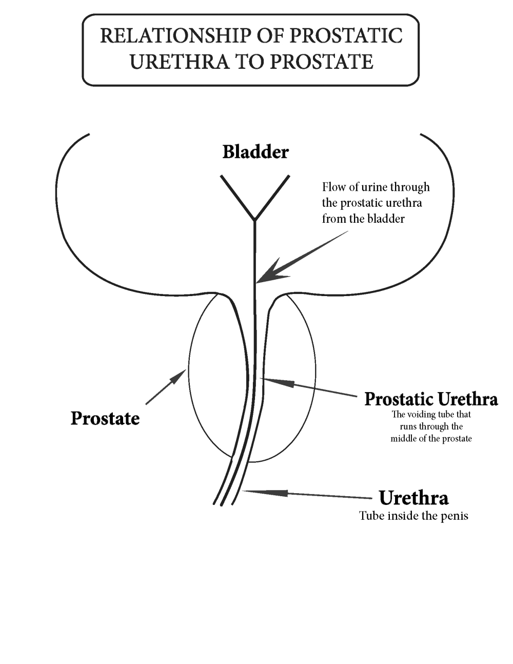 8_relationship of bladder to prostatic_urethra.tiff